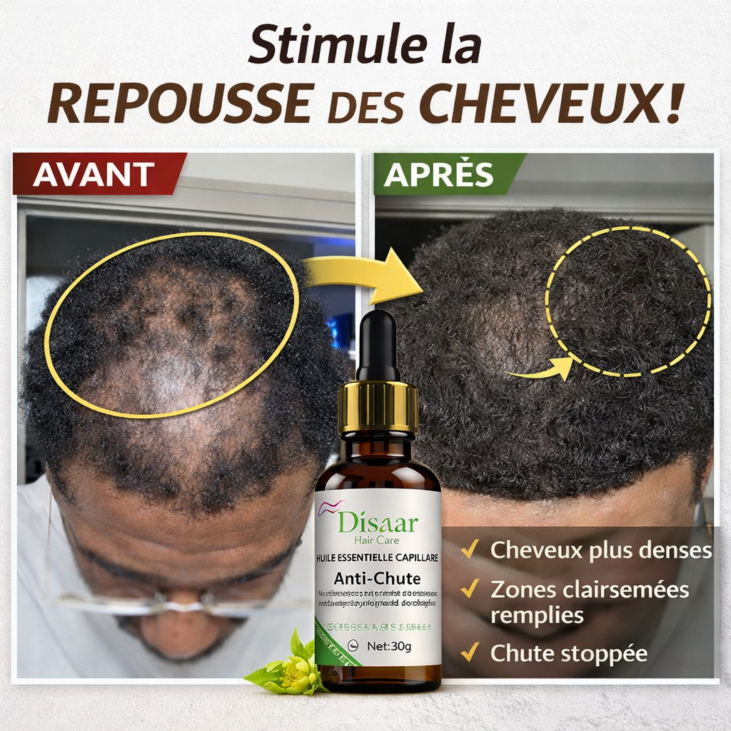 REPOUSSER VOS CHEVEUX NATURELLEMENT EN 14J🔥